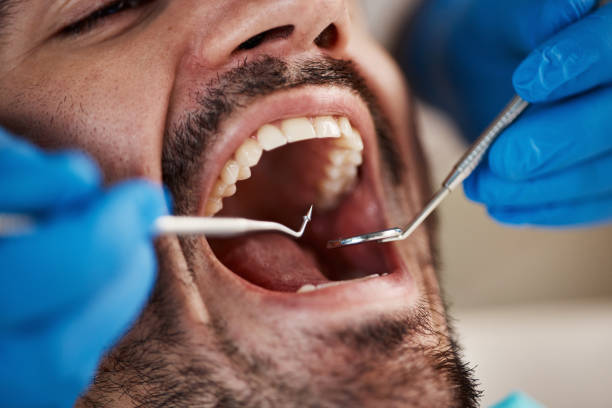 Best Cosmetic Emergency Dentistry in Mpbell, CA