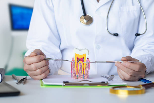 Best Emergency Tooth Extraction in Mpbell, CA