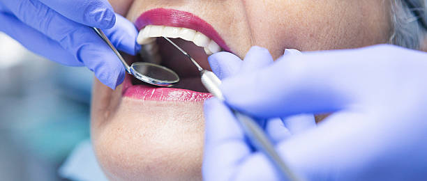 Best After-Hours Dental Trauma Care in Mpbell, CA